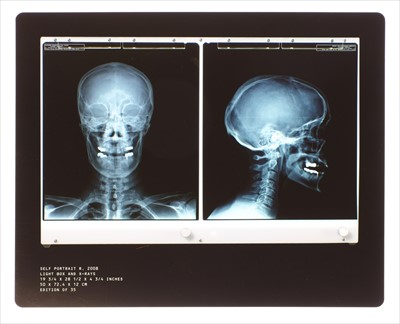 Lot 380 - AFTER DAMIEN HIRST (b.1965)