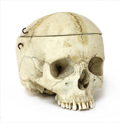 Lot 212 - HUMAN SKULL