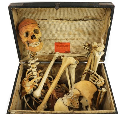 Lot 189 - SKELETON IN A TRUNK