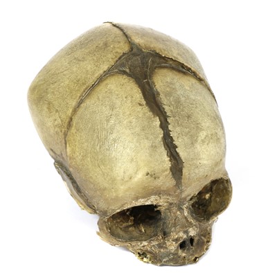 Lot 176 - BABY'S SKULL