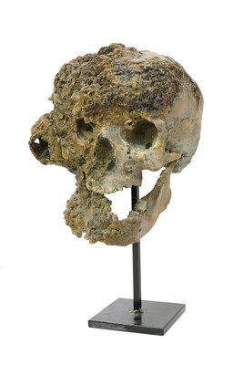 Lot 80 - A DISEASED HUMAN SKULL MODEL