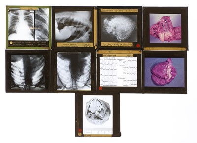 Lot 419 - A large collection of medical glass slides