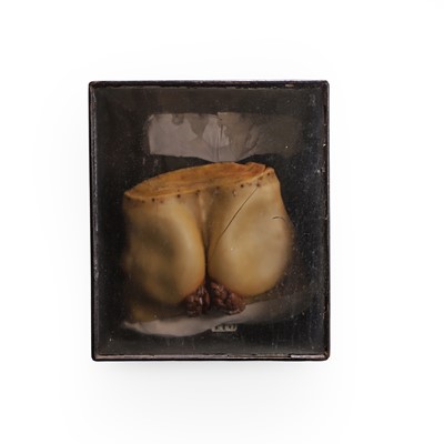 Lot 313 - A cased wax medical diorama